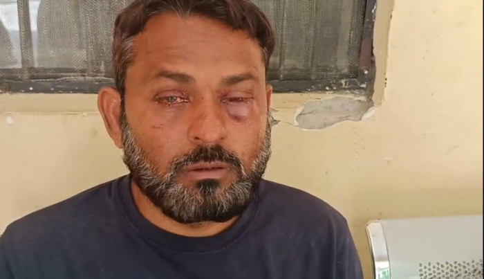 पहली पत्नी के परिजनों का घर पर हमला, तीन लोग लहूलुहान – CCTV में पूरी वारदात कैद